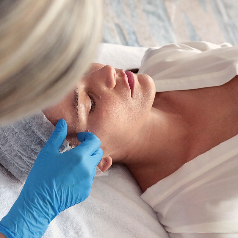 Dermapen4 behandeling